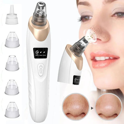 Deep Pore Cleaner – Electric Blackhead Removal Device