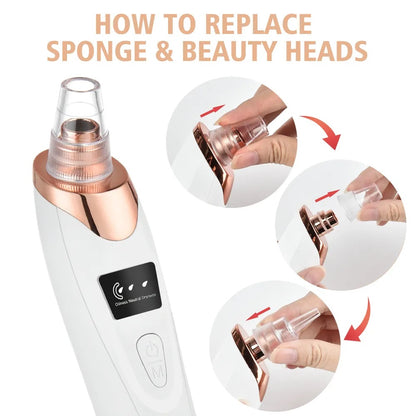 Deep Pore Cleaner – Electric Blackhead Removal Device