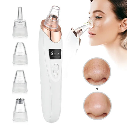 Deep Pore Cleaner – Electric Blackhead Removal Device