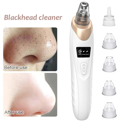 Deep Pore Cleaner – Electric Blackhead Removal Device