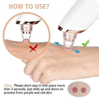 Deep Pore Cleaner – Electric Blackhead Removal Device