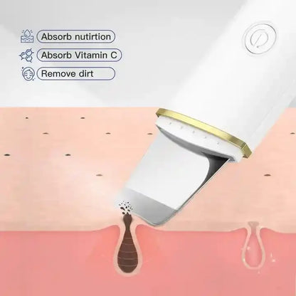 Deep Clean Ultrasonic Skin Scrubber – Professional Face Tool