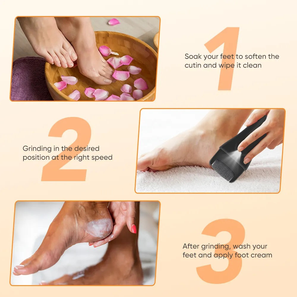 Electric Foot File & Callus Remover – Rechargeable Foot Care Tool