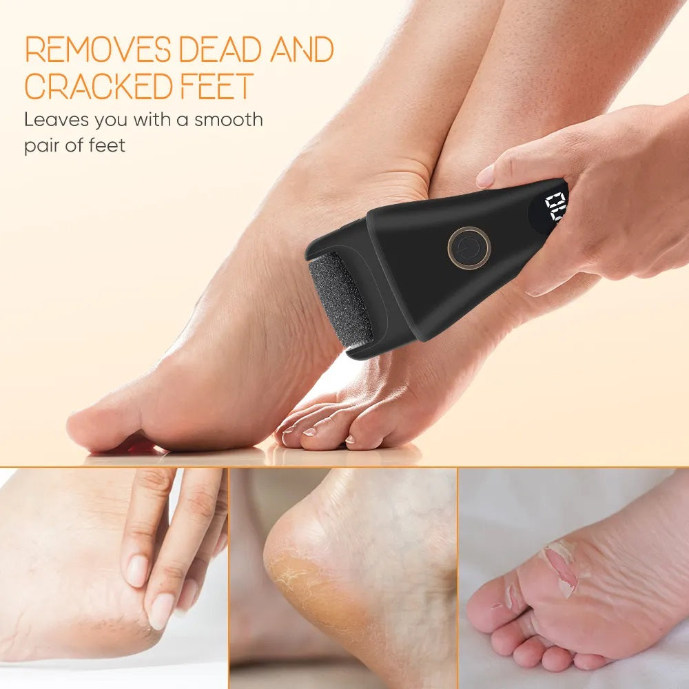 Electric Foot File & Callus Remover – Rechargeable Foot Care Tool
