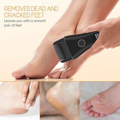 Electric Foot File & Callus Remover – Rechargeable Foot Care Tool
