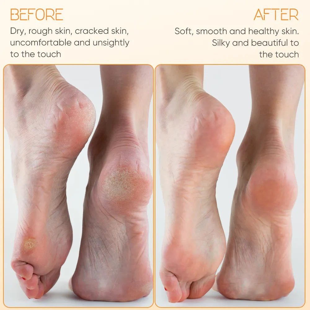 Electric Foot File & Callus Remover – Rechargeable Foot Care Tool