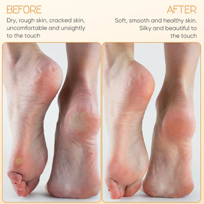 Electric Foot File & Callus Remover – Rechargeable Foot Care Tool
