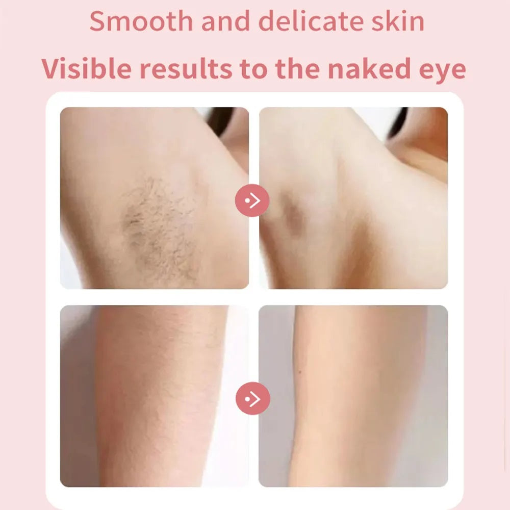 2-in-1 Wet & Dry Electric Lady Shaver & Trimmer for Bikini, Legs, and Underarms